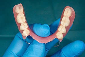 Dentist holding a partial denture