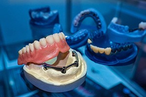 An implant denture on a table