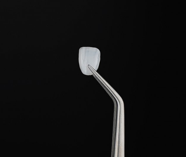 Veneer held with tweezers